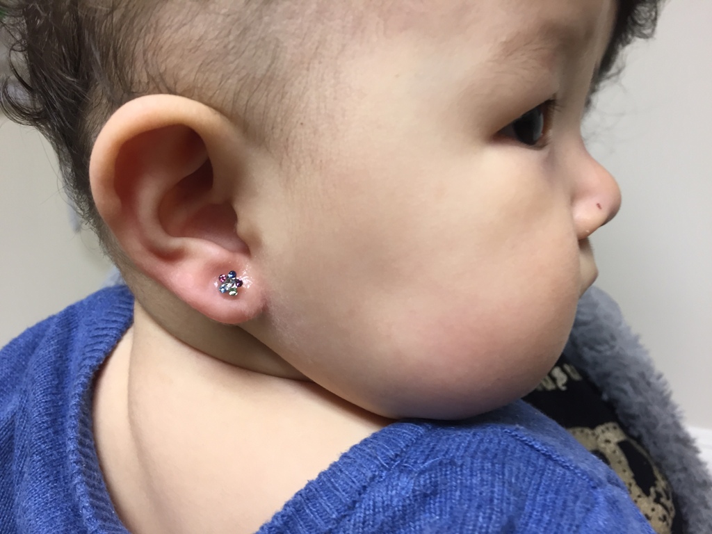 We do ear piercing from three months and older.